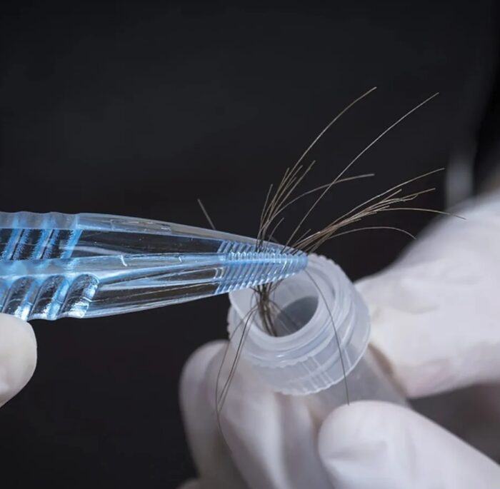 Tissue Mineral (Hair) Analysis